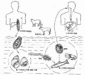 华支睾吸虫