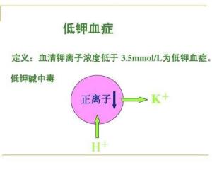 低钾血症