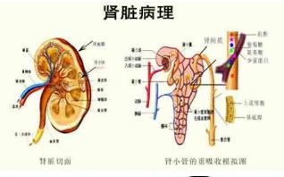 肾炎